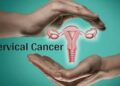 cervical cancer in Nigeria heightens