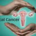 cervical cancer in Nigeria heightens