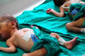 UN REPORT SAYS GLOBAL CHILD DEATHS DROPPED TO 4.9M IN 2022