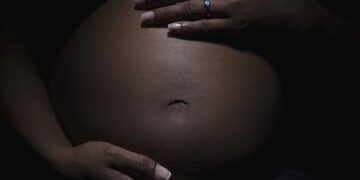 BABIES OF PREGNANT WOMEN EXPOSED TO RADIATION RISK CANCER