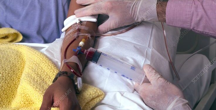 CARRYING OUT GENOTYPE TEST AFTER BLOOD TRANSFUSION MAY PRODUCE INCONSISTENT RESULT, SCIENTISTS WARN