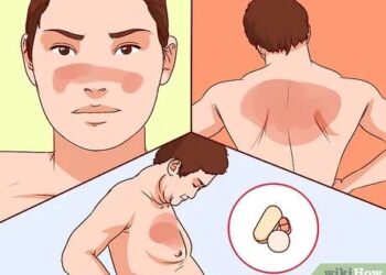 RHEUMATOLOGIST CALLS FOR ENHANCED HEALTHCARE FOR LUPUS PATIENTS