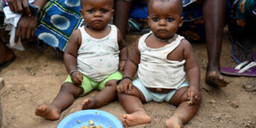 CHILDREN SUFFERING FROM MALNUTRITION MAY HAVE LOW IQ