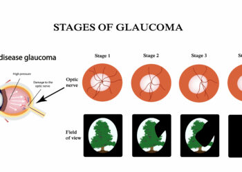 HOW GLAUCOMA, RETINAL DISEASE CAUSES IRREVERSIBLE BLINDNESS – OPHTHALMOLOGISTS