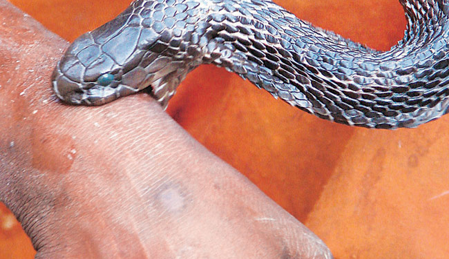 GOMBE URGES FG TO BOOST ANTIVENOM PRODUCTION TO TREAT SNAKE BITES