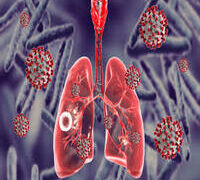 NIGERIA’S TB PROGRAM SURPASSES TARGET MILESTONES, SAYS HEALTH MINISTRY.