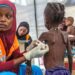 STAKEHOLDERS, FG TO COLLABORATE AGAINST MALNUTRITION IN NORTHERN NIGERIA