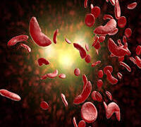 GROUP URGES NASS TO REVISIT, ENACT SICKLE CELL BILL