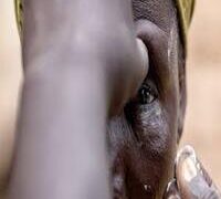 KOGI STATE COMMITS TO FUNDING EYE CARE PROGRAMME