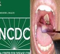 NCDC CONFIRMS 7,784 DIPHTHERIA CASES IN 170 LGAs IN NIGERIA.