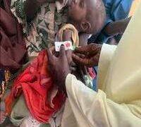 ONE IN FOUR CHILDREN UNDER FIVE YEARS MALNOURISHED IN ZAMFARA STATE.
