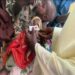 ONE IN FOUR CHILDREN UNDER FIVE YEARS MALNOURISHED IN ZAMFARA STATE.