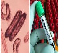 RWANDA RECORDS 27 MARBURG VIRUS CASES, NINE DEATHS