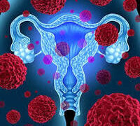 NIGERIA RECORDS 38 CERVICAL CANCER CASES DAILY – GYNAECOLOGISTS.