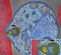 WHO TARGETS MALARIA PARASITES, 16 OTHER DEADLY PATHOGENS FOR VACCINE DEVELOPMENT