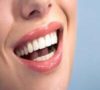 TEETH WHITENING IN BEAUTY SALONS ILLEGAL, SAYS NDA PRESIDENT.