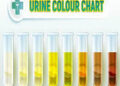 WHAT YOUR URINE COLOUR SAYS ABOUT YOUR KIDNEYS.