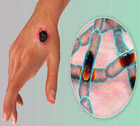 KANO LG BEGINS ANTHRAX VACCINATION.