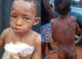 10-YEAR-OLD ASSAULT VICTIM RECEIVING TREATMENT -ANAMBRA COMMISSIONER.
