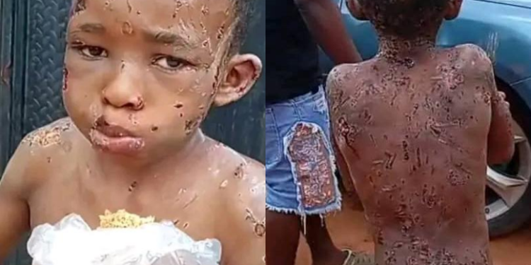 10-YEAR-OLD ASSAULT VICTIM RECEIVING TREATMENT -ANAMBRA COMMISSIONER.